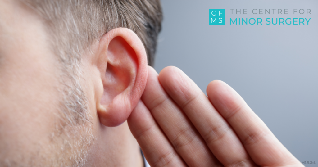 Man pointing to his repaired ear lobe (model)